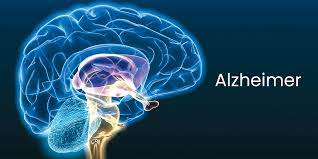 La terapia hormonal puede aumentar levemente el riesgo de Alzheimer